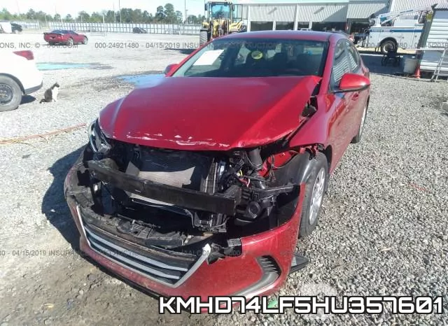 KMHD74LF5HU357601 фото 7