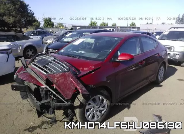 KMHD74LF6HU086130 фото 3