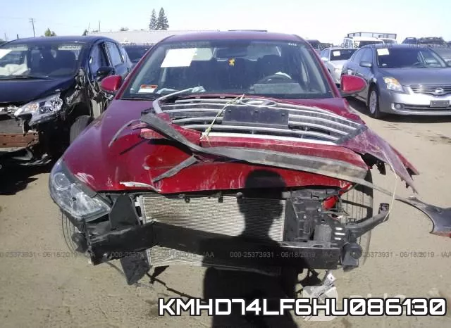 KMHD74LF6HU086130 фото 7