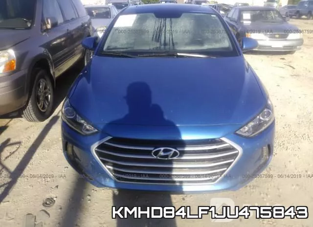 KMHD84LF1JU475843 фото 6