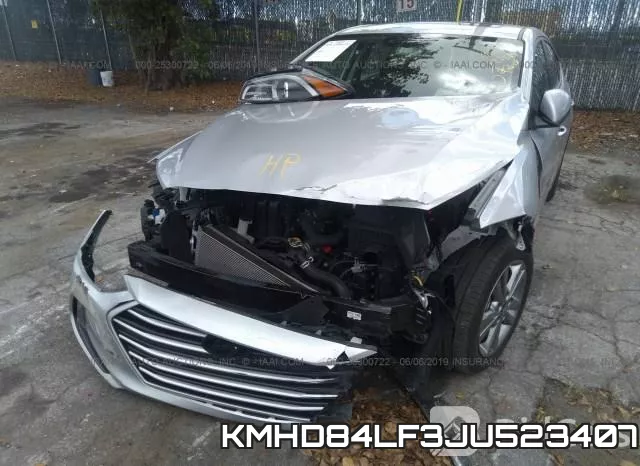 KMHD84LF3JU523407 фото 7