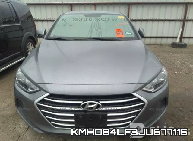 KMHD84LF3JU677115 фото 6