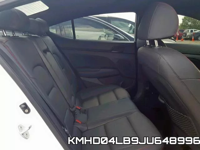 KMHD04LB9JU648996 фото 7