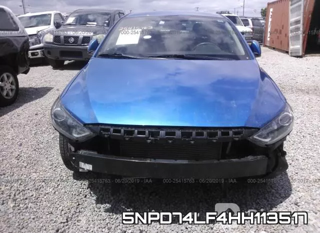 5NPD74LF4HH113517 фото 7