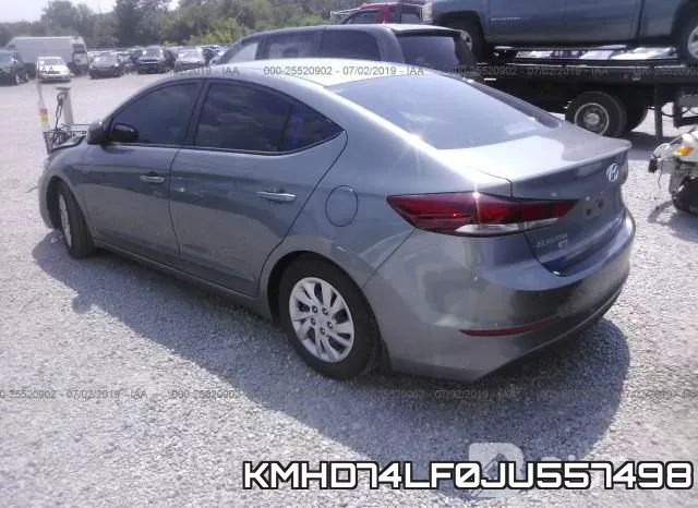 KMHD74LF0JU557498 фото 4