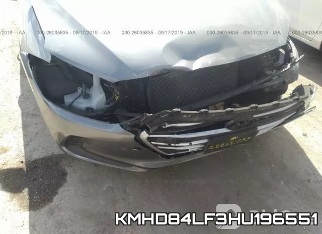 KMHD84LF3HU196551 фото 7