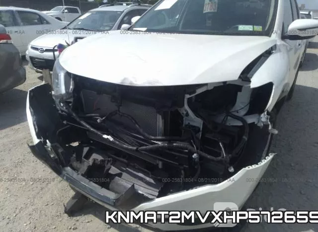 KNMAT2MVXHP572659 фото 7