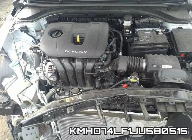 KMHD74LF1JU580515 фото 2
