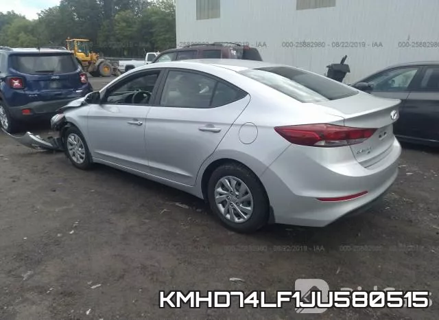 KMHD74LF1JU580515 фото 4