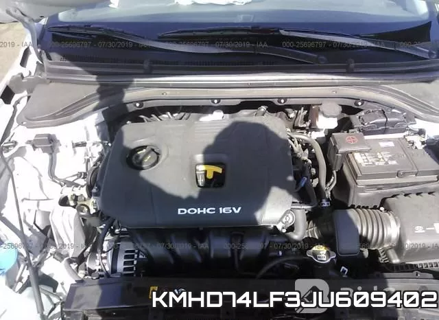 KMHD74LF3JU609402 фото 2