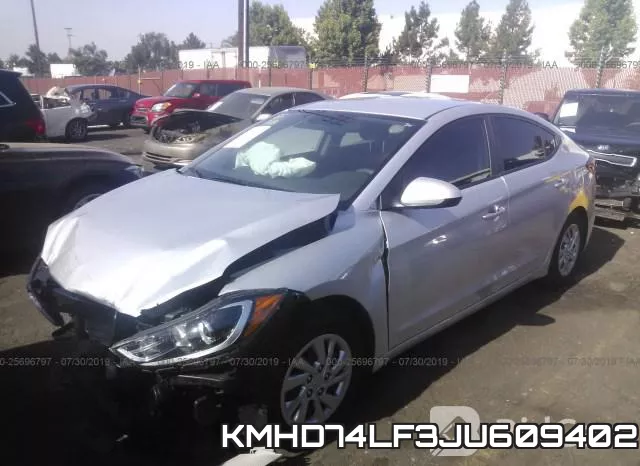 KMHD74LF3JU609402 фото 3