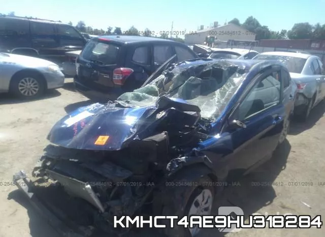 KMHCT4AE9HU318284 фото 3