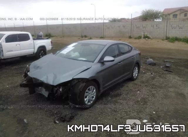 KMHD74LF3JU631657 фото 3