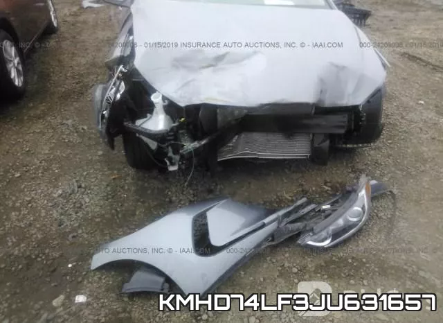 KMHD74LF3JU631657 фото 6