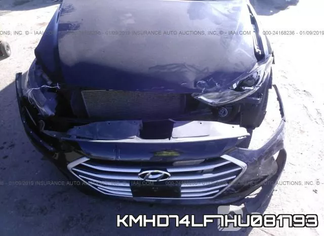 KMHD74LF7HU081793 фото 7