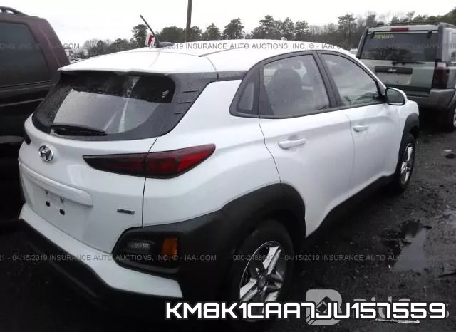 KM8K1CAA7JU157559 фото 5