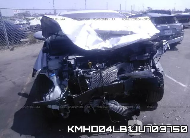 KMHD04LB1JU703750 фото 7