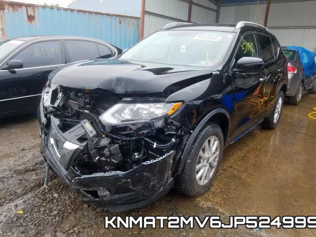 KNMAT2MV6JP524999 фото 3