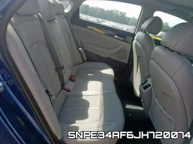 5NPE34AF6JH720074 фото 7