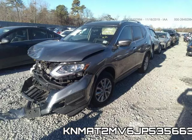 KNMAT2MV6JP535663 фото 3