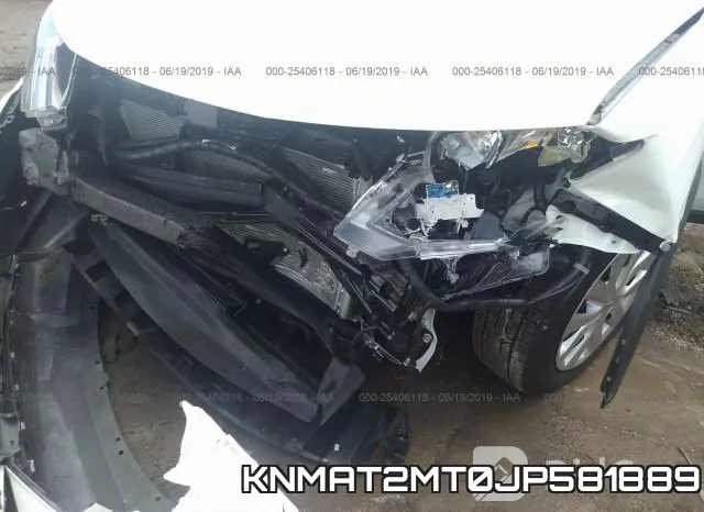 KNMAT2MT0JP581889 фото 7
