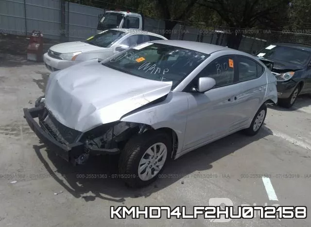 KMHD74LF2HU072158 фото 2