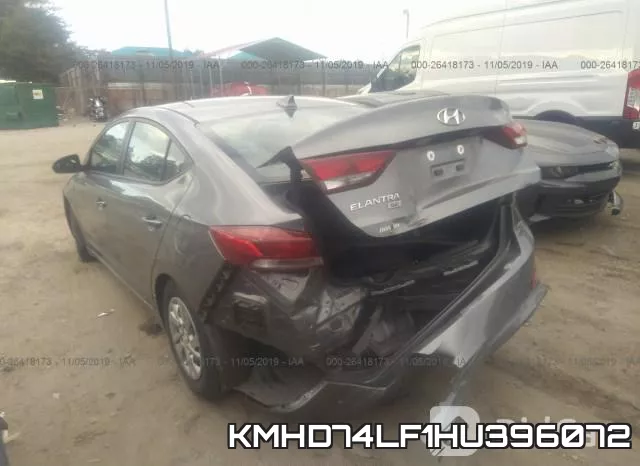 KMHD74LF1HU396072 фото 6
