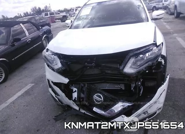 KNMAT2MTXJP551654 фото 6