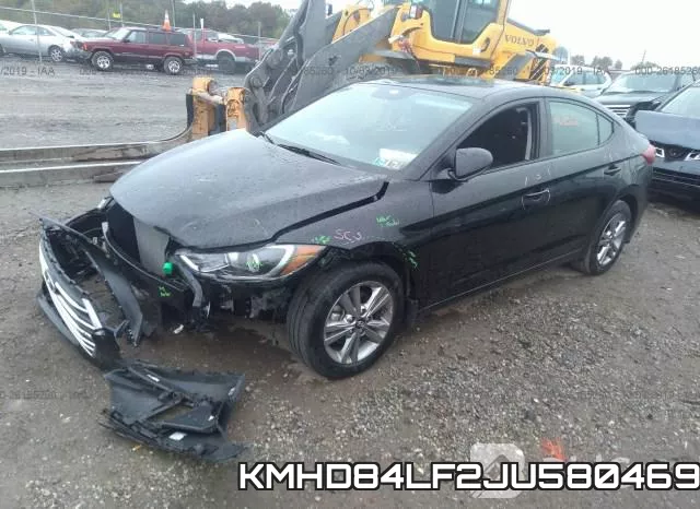 KMHD84LF2JU580469 фото 3