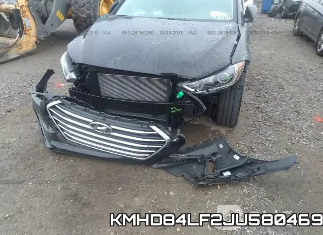 KMHD84LF2JU580469 фото 7