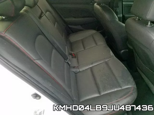 KMHD04LB9JU487436 фото 6