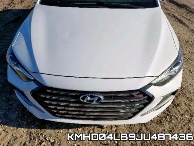 KMHD04LB9JU487436 фото 9