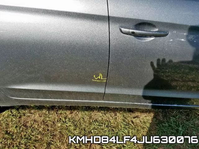 KMHD84LF4JU630076 фото 10