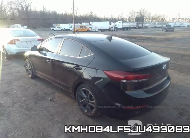 KMHD84LF5JU493083 фото 3