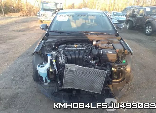 KMHD84LF5JU493083 фото 6