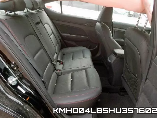 KMHD04LB5HU357602 фото 7