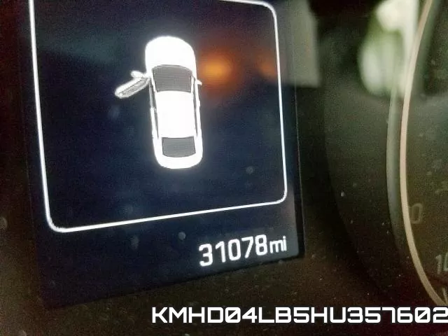 KMHD04LB5HU357602 фото 9