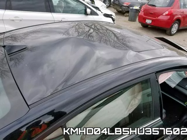 KMHD04LB5HU357602 фото 10