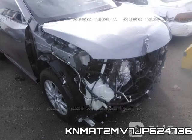 KNMAT2MV7JP524736 фото 7