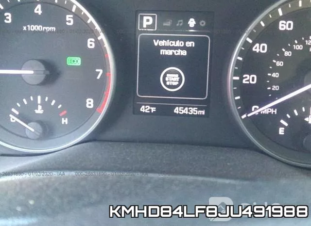 KMHD84LF8JU491988 фото 8