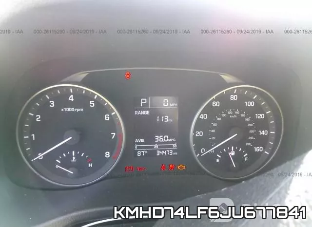 KMHD74LF6JU677841 фото 7