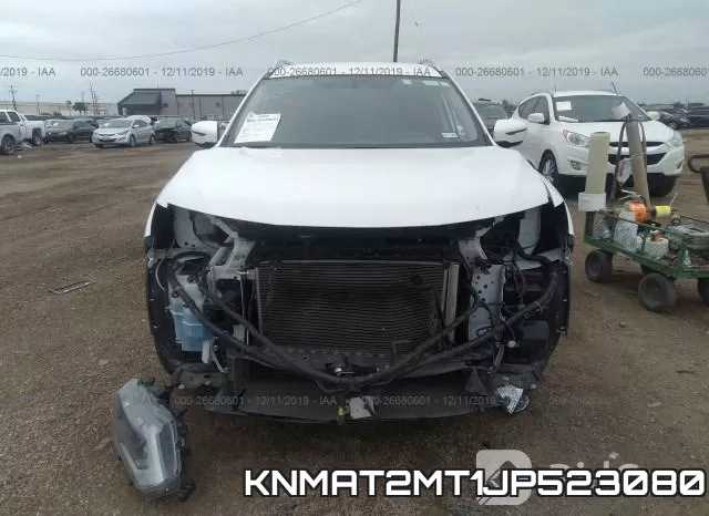KNMAT2MT1JP523080 фото 6