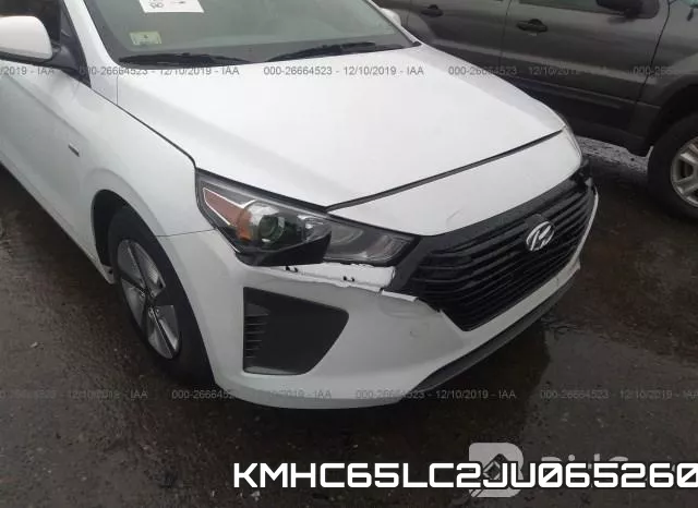 KMHC65LC2JU065260 фото 6