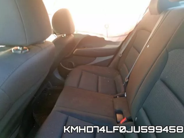 KMHD74LF0JU599458 фото 6