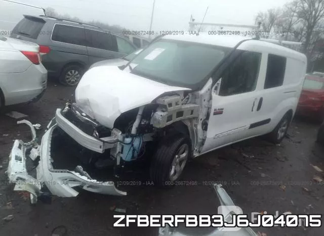 ZFBERFBB3J6J04075 фото 3