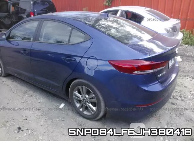 5NPD84LF6JH380418 фото 4