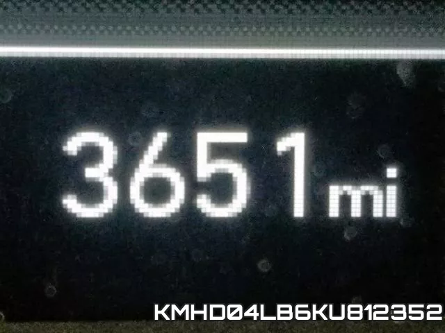 KMHD04LB6KU812352 фото 8