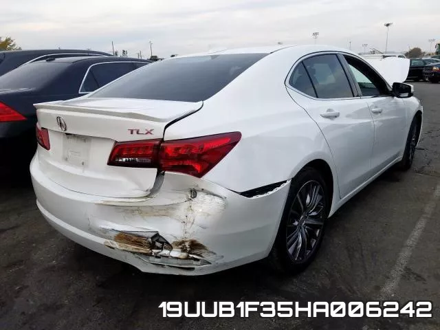 19UUB1F35HA006242 фото 5