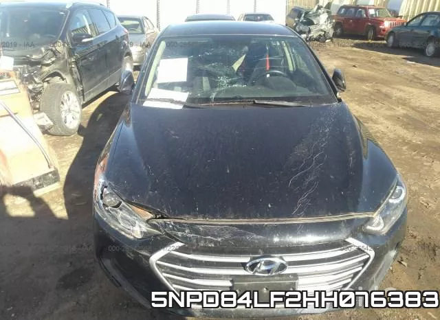 5NPD84LF2HH076383 фото 6