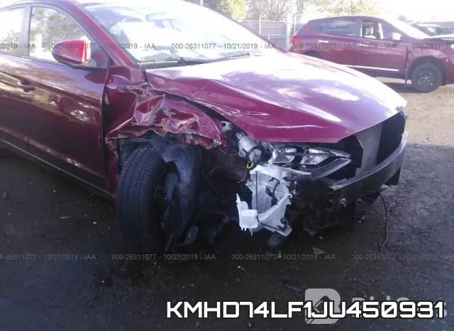 KMHD74LF1JU450931 фото 7